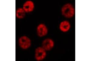 ABIN6267660 staining HeLa by IF/ICC. (SMAD1 anticorps  (pSer465))