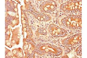 IHC image of ABIN7171957 diluted at 1:1200 and staining in paraffin-embedded human small intestine tissue performed on a Leica BondTM system.