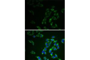 Immunofluorescence analysis of HeLa cells using  antibody (ABIN3021755, ABIN3021756, ABIN3021757 and ABIN6215776).