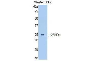Western Blotting (WB) image for anti-Interleukin 13 Receptor, alpha 1 (IL13RA1) (AA 203-376) antibody (ABIN1174859) (IL13 Receptor alpha 1 anticorps  (AA 203-376))