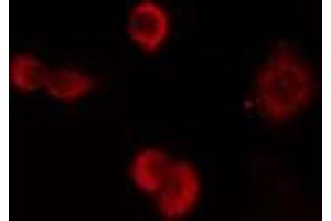 ABIN6274180 staining HuvEc cells by IF/ICC.