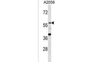 ZN Antibody (N-term) (ABIN1539362 and ABIN2849856) western blot analysis in  cell line lysates (35 μg/lane). (ZNF776 anticorps  (N-Term))