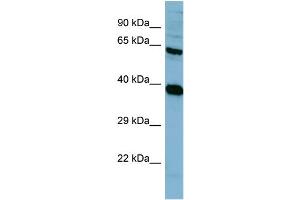 Western Blotting (WB) image for anti-Protein Phosphatase 2, Regulatory Subunit A, alpha (PPP2R1A) (N-Term) antibody (ABIN2787389)