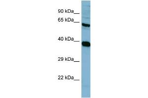 Western Blotting (WB) image for anti-Protein Phosphatase 2, Regulatory Subunit A, alpha (PPP2R1A) (N-Term) antibody (ABIN2787389) (PPP2R1A anticorps  (N-Term))