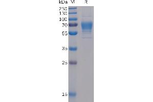 Human CD30 Ligand Protein, mFc-His Tag on SDS-PAGE under reducing condition.