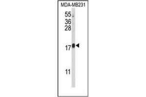 Western blot analysis of CBY1 Antibody (C-term) in MDA-MB231 cell line lysates (35ug/lane). (CBY1/PGEA1 anticorps  (C-Term))