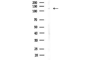 anti-Ubiquitin Conjugation Factor E4 B (UBE4B) (N-Term) antibody