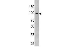 TLR5 antibody used in western blot to detect TLR5 in HL-60 cell lysate