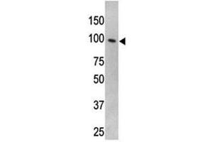 TLR5 antibody used in western blot to detect TLR5 in HL-60 cell lysate (TLR5 anticorps  (AA 71-102))