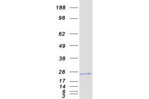 Validation with Western Blot