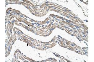 IDH3A antibody was used for immunohistochemistry at a concentration of 4-8 ug/ml to stain Skeletal muscle cells (arrows) in Human Muscle. (IDH3A anticorps)