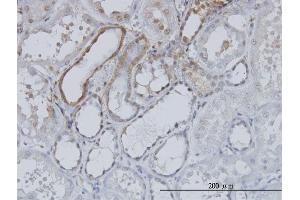 Immunoperoxidase of monoclonal antibody to TP53 on formalin-fixed paraffin-embedded human kidney.