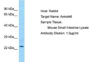 Host: Rabbit Target Name: ANKRD46 Sample Tissue: Mouse Small Intestine Antibody Dilution: 1ug/ml (ANKRD46 anticorps  (C-Term))