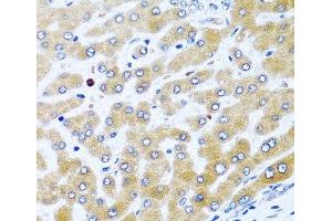 Immunohistochemistry of paraffin-embedded Human liver using CCL21 Polyclonal Antibody at dilution of 1:100 (40x lens). (CCL21 anticorps)
