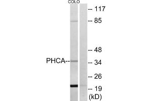 Western blot analysis of extracts from COLO cells, using PHCA antibody. (ACER3 anticorps  (Internal Region))