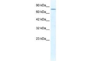 Western Blotting (WB) image for anti-DEAD (Asp-Glu-Ala-Asp) Box Polypeptide 23 (DDX23) antibody (ABIN2461345)