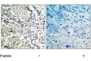 Image no. 1 for anti-Mitogen-Activated Protein Kinase Kinase 3 (MAP2K3) (Ser189) antibody (ABIN197297) (MAP2K3 anticorps  (Ser189))