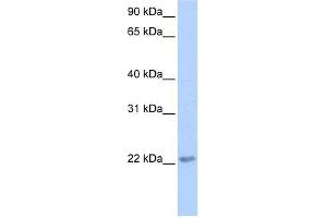 TCEAL2 antibody used at 0. (TCEAL2 anticorps  (N-Term))