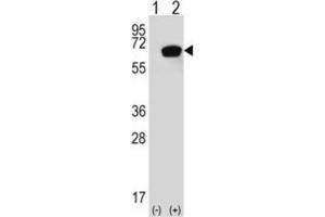 Western Blotting (WB) image for anti-Heat Shock 70kDa Protein 1A (HSPA1A) antibody (ABIN3003299) (HSP70 1A anticorps)