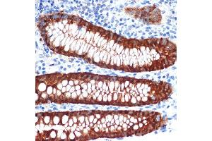 Immunohistochemistry of paraffin-embedded human appendix using Galectin 4/LG Rabbit mAb (ABIN1679347, ABIN3017979, ABIN3017980 and ABIN7101554) at dilution of 1:100 (40x lens). (GAL4 anticorps)