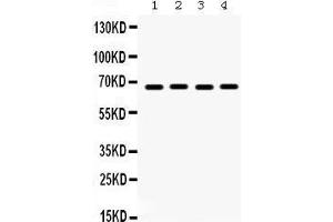 Western Blotting (WB) image for anti-Ets Variant 4 (ETV4) (AA 1-41), (N-Term) antibody (ABIN3042379)