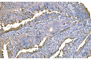 IHC analysis of Prothrombin using anti-Prothrombin antibody (ABIN7602705). (Prothrombin Fragment 2 (AA 97-124) anticorps)