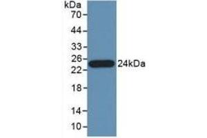 Detection of Recombinant PTa, Human using Polyclonal Antibody to Pancreas Specific Transcription Factor 1a (PTF1a) (PTF1A anticorps  (AA 177-328))