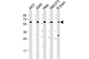 All lanes : Anti-PICALM Antibody (Center) at 1:2000 dilution Lane 1: A431 whole cell lysates Lane 2: A549 whole cell lysates Lane 3: Hela whole cell lysates Lane 4: NIH/3T3 whole cell lysates Lane 5: rat brain lysates Lysates/proteins at 20 μg per lane. (PICALM anticorps  (AA 385-415))
