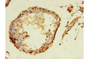 Immunohistochemistry of paraffin-embedded human testis tissue using ABIN7172949 at dilution of 1:100 (TMCO5A anticorps  (AA 10-192))