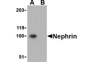Western blot analysis of Nephrin in mouse kidney tissue lysate with Nephrin antibody at 1 µg/mL in the (A) absence and (B) presence of blocking peptide. (Nephrin anticorps  (C-Term))