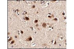 Immunohistochemistry of Slitrk4 in human brain tissue with this product at 2.