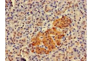 Immunohistochemistry of paraffin-embedded human pancreatic tissue using ABIN7173936 at dilution of 1:100 (TWF1 anticorps  (AA 199-252))