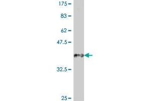 Western Blot detection against Immunogen (37.