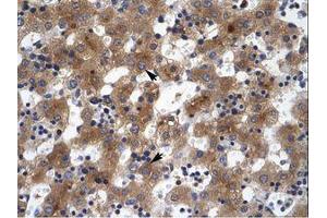 Image no. 1 for anti-Zinc Finger Protein 551 (ZNF551) (AA 169-218) antibody (ABIN203081) (ZNF551 anticorps  (AA 169-218))