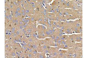 ABIN6258654 and ABIN6275038 at 1/100 staining rat brain tissue by IHC-P.