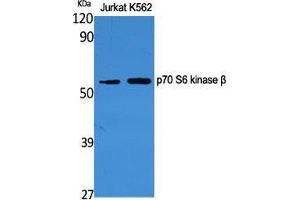 Western Blot (WB) analysis of specific cells using p70 S6 kinase beta Polyclonal Antibody. (RPS6KB2 anticorps  (Tyr1016))