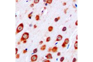 Immunohistochemical analysis of CRHR2 staining in human brain formalin fixed paraffin embedded tissue section.