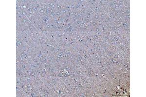 IHC analysis of GNB3 using anti-GNB3 antibody (ABIN7599726).