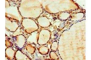 Immunohistochemistry of paraffin-embedded human thyroid tissue using ABIN7169127 at dilution of 1:100 (PAK2 anticorps  (AA 1-212))