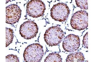 IHC analysis of Symplekin/SYMPK using anti-Symplekin/SYMPK antibody (ABIN7601558). (Symplekin anticorps  (AA 384-1092))