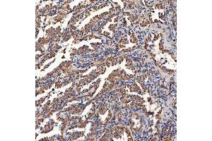 IHC analysis of SCO1 using anti-SCO1 antibody (ABIN7600609). (SCO1 anticorps  (AA 21-301))