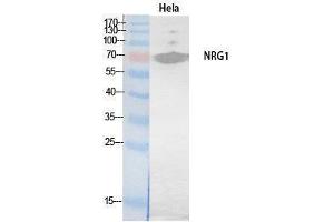 Western Blotting (WB) image for anti-Neuregulin 1 (NRG1) (Internal Region) antibody (ABIN3178546) (Neuregulin 1 anticorps  (Internal Region))