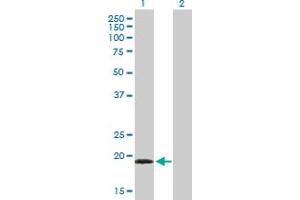 Western Blot analysis of TPPP3 expression in transfected 293T cell line by TPPP3 MaxPab polyclonal antibody. (TPPP3 anticorps  (AA 1-176))