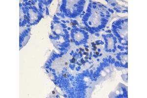 IHC analysis of CD3 epsilon/Cd3e using anti-CD3 epsilon/Cd3e antibody (ABIN7600665). (CD3 epsilon anticorps  (AA 22-113))
