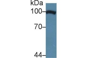 Detection of TNPO1 in Human Hela cell lysate using Polyclonal Antibody to Transportin 1 (TNPO1)