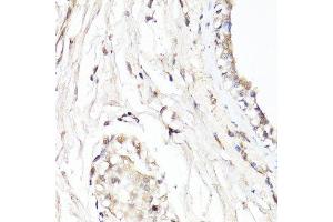 Immunohistochemistry of paraffin-embedded human breast using CDK7 antibody.