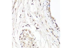 Immunohistochemistry of paraffin-embedded human breast using CDK7 antibody. (CDK7 anticorps  (AA 211-346))