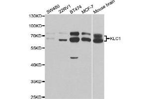 Western Blotting (WB) image for anti-Kinesin Light Chain 1 (KLC1) antibody (ABIN1876732) (KLC1 anticorps)