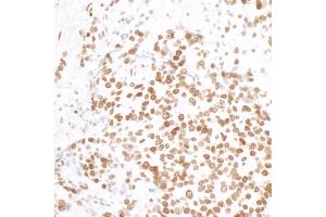 Immunohistochemistry (IHC) image for anti-H2A Histone Family, Member X (H2AFX) (AA 93-143) antibody (ABIN7449452)