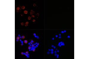 anti-SARS-CoV-2 Spike S2 antibody